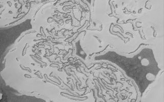 <h1>PIA05694:  Carbon Dioxide Landforms</h1><div class="PIA05694" lang="en" style="width:800px;text-align:left;margin:auto;background-color:#000;padding:10px;max-height:150px;overflow:auto;">19 March 2004<br />The martian south polar residual ice cap is mostly made of frozen carbon dioxide. There is no place on Earth that a person can go to see the landforms that would be produced by erosion and sublimation of hundreds or thousands of cubic kilometers of carbon dioxide. Thus, the south polar cap of Mars is as alien as alien can get. This image, acquired in February 2004 by the Mars Global Surveyor (MGS) Mars Orbiter Camera (MOC), shows how the cap appears in summer as carbon dioxide is subliming away, creating a wild pattern of pits, mesas, and buttes. Darker surfaces may be areas where the ice contains impurities, such as dust, or where the surface has been roughened by the removal of ice. This image is located near 86.3°S, 0.8°W. This picture covers an area about 3 km (1.9 mi) across. Sunlight illuminates the scene from the top/upper left.<br /><br /><a href="http://photojournal.jpl.nasa.gov/catalog/PIA05694" onclick="window.open(this.href); return false;" title="Voir l'image 	 PIA05694:  Carbon Dioxide Landforms	  sur le site de la NASA">Voir l'image 	 PIA05694:  Carbon Dioxide Landforms	  sur le site de la NASA.</a></div>